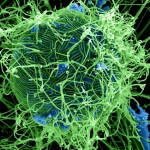 Ebola virus (green) attached to a human cell (blue). Credit: NAID